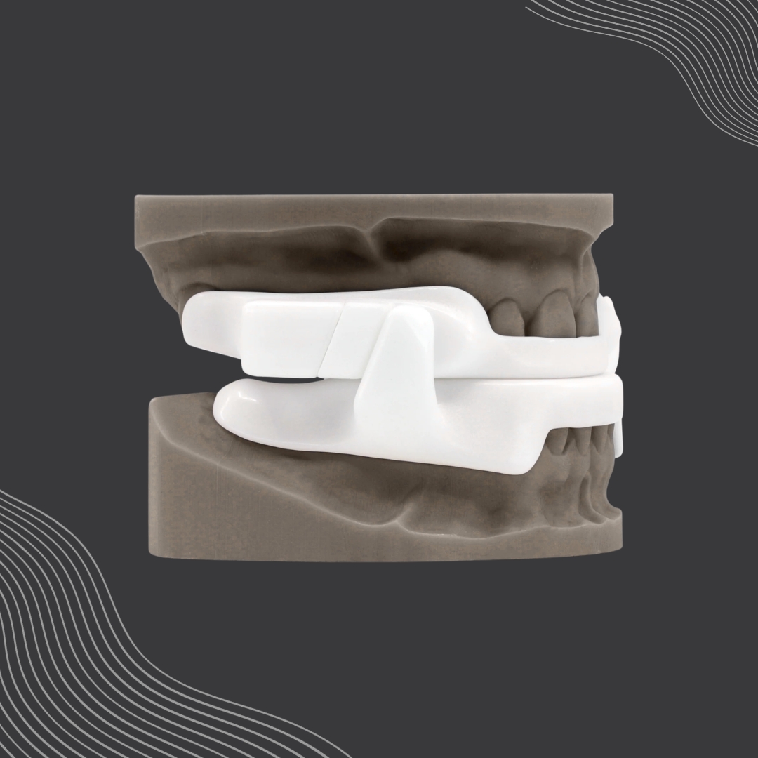 Sleep device consultation at Dream Smiles Dental in Bolton