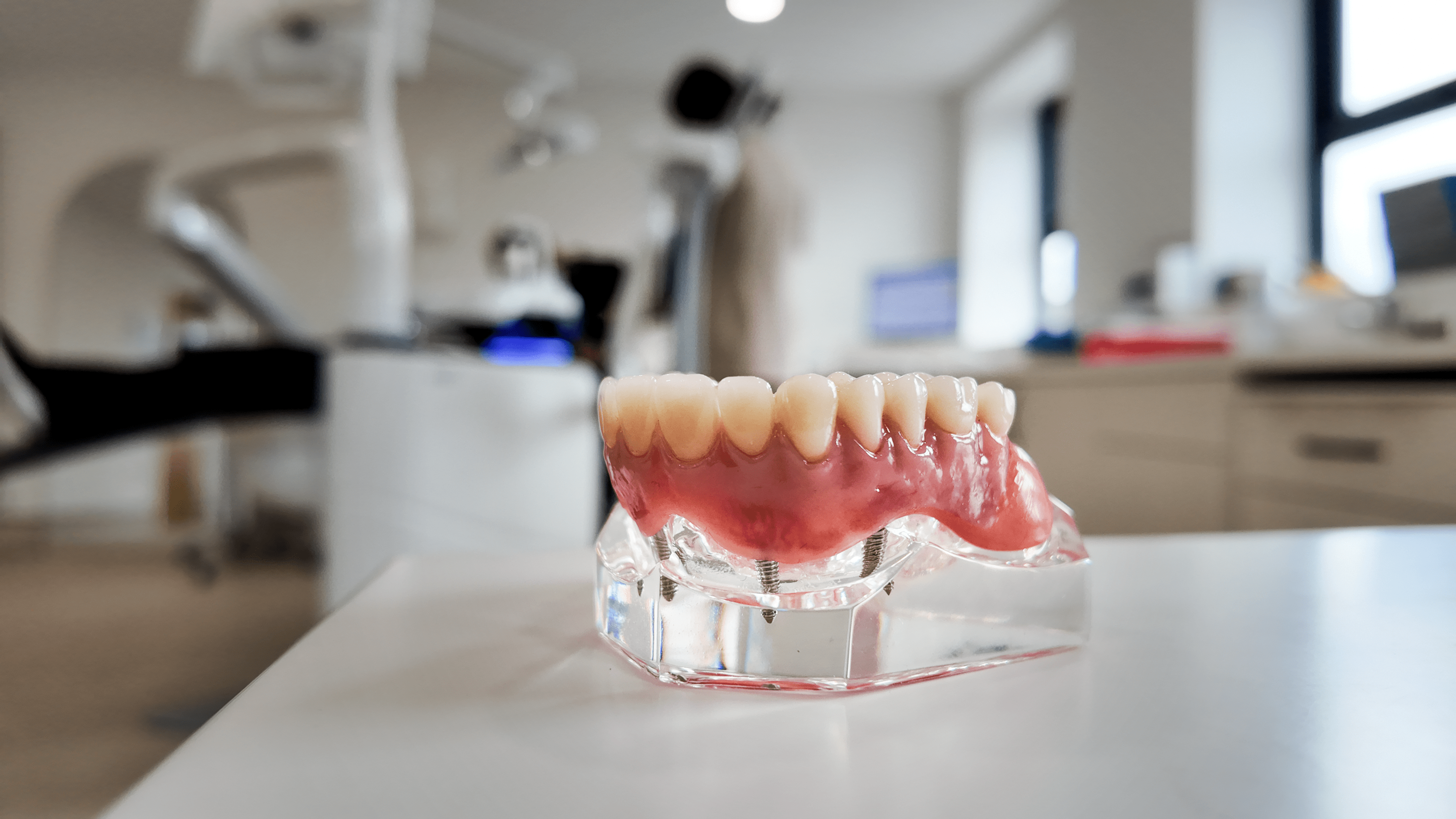 Dental bridge model showing replacement teeth used to restore a complete smile
