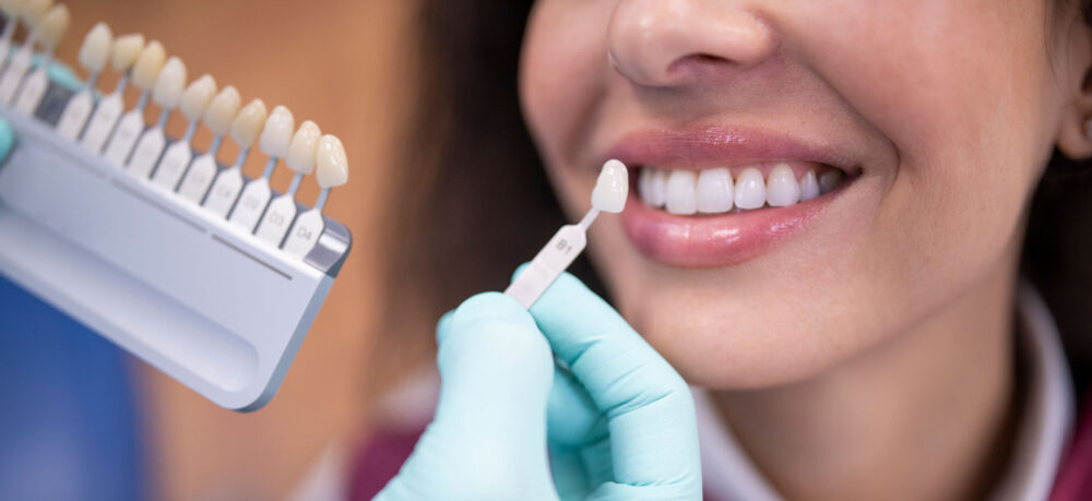 Dentist using a palette tooth color sample