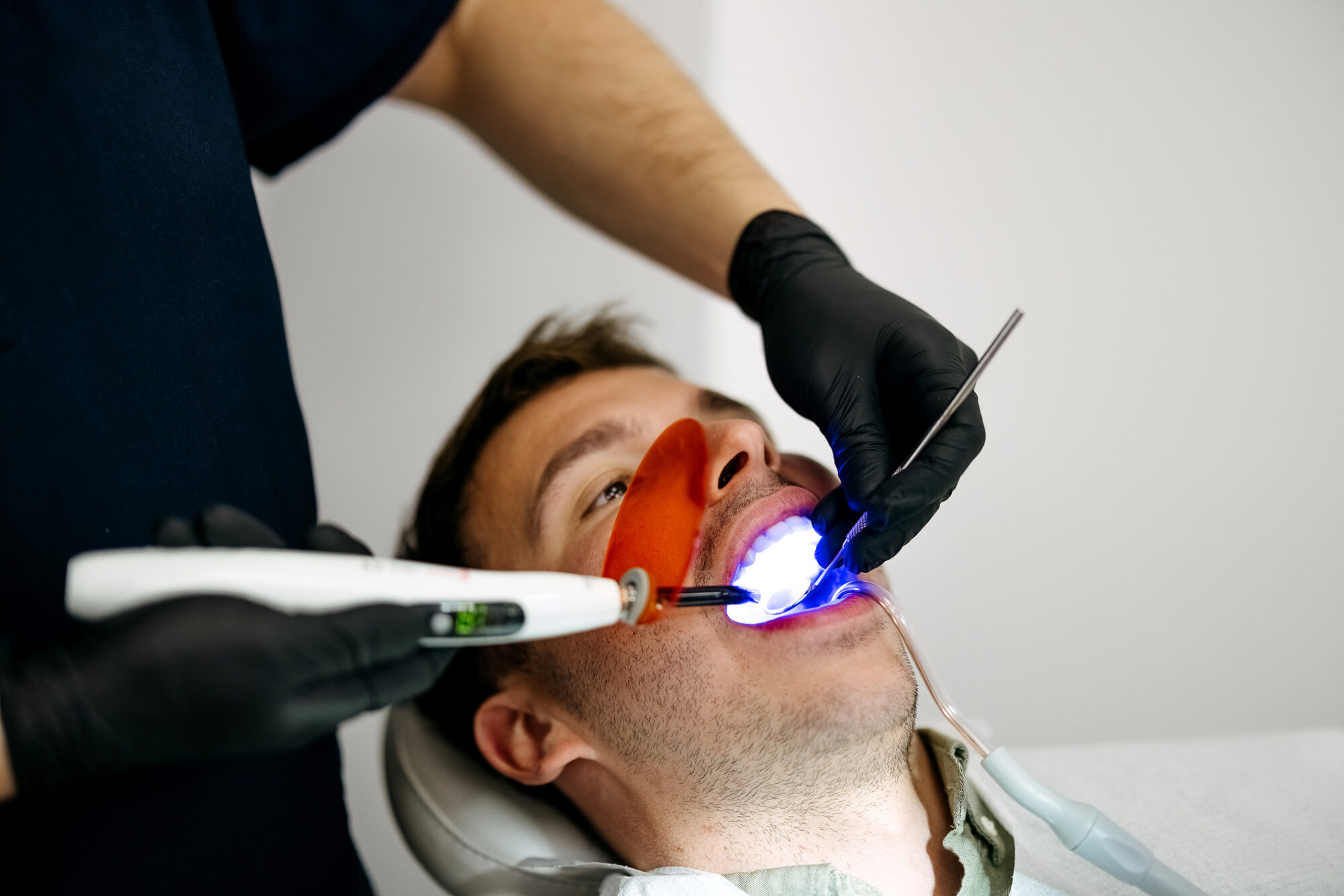 Composite Bonding in Bolton: The Simple Solution for a Flawless Smile