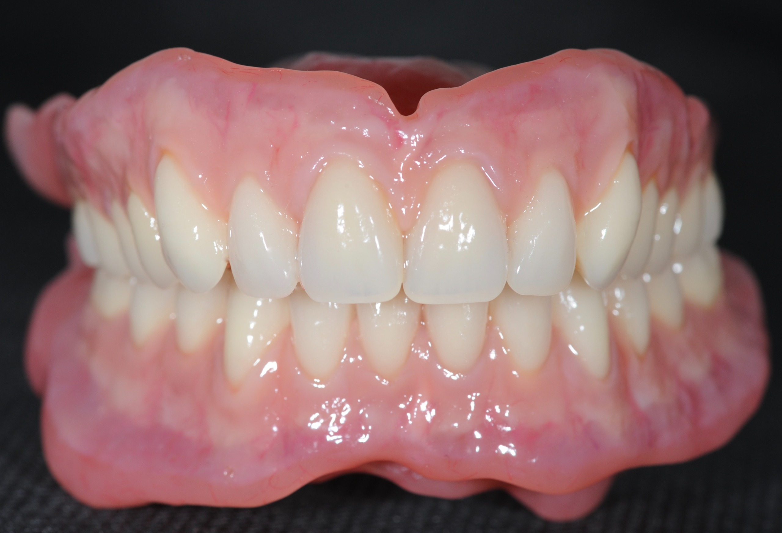 John Wibberley's finished denture