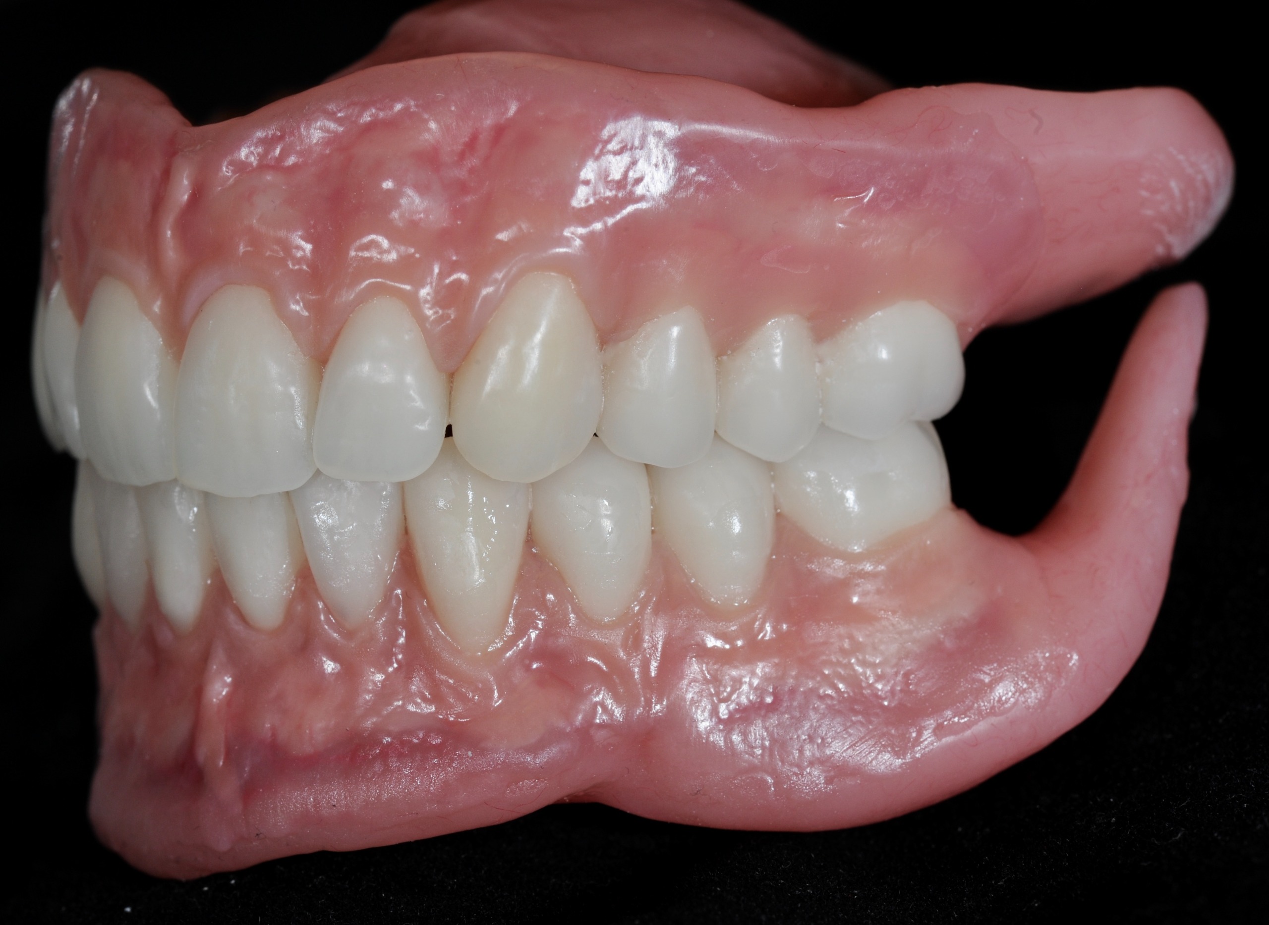 Denture result