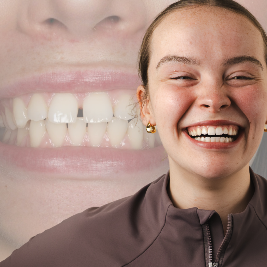 Transform your smile