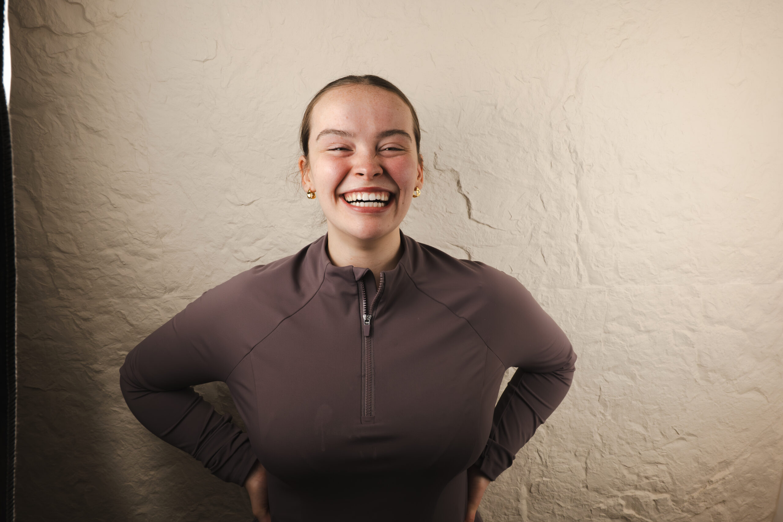 Invisalign before and after result