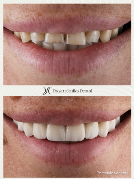 Dream Smiles Dental Instagram