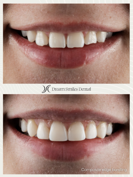Dream Smiles Dental Instagram